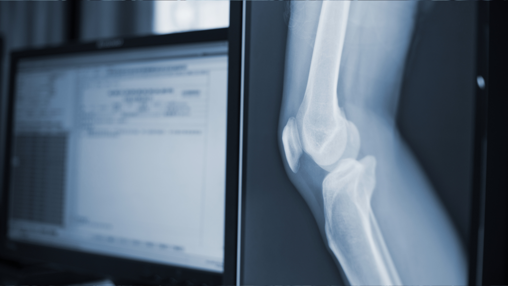 PATENT SEARCH SERVICES Freelance Mechanical Patent Searcher London invalidity validity patent search uk